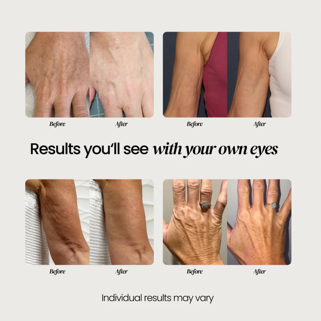 Advanced Crepe Fix for crepey, densely creased or paper like skin - Image 15