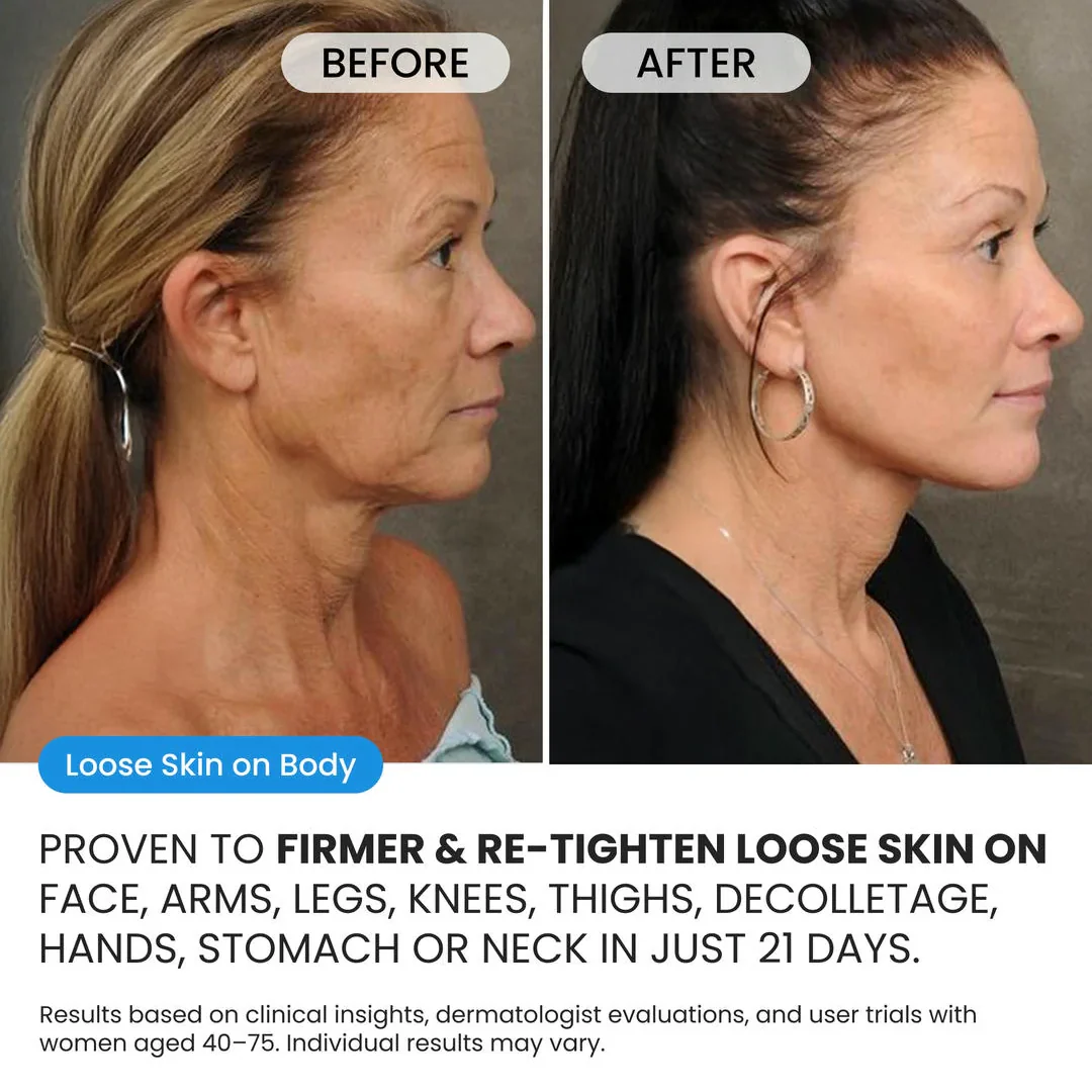 Advanced Crepe Fix for crepey, densely creased or paper like skin - Image 2