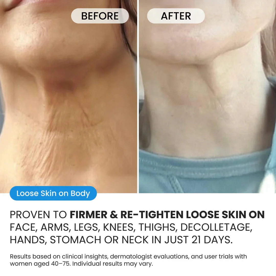 Advanced Crepe Fix for crepey, densely creased or paper like skin - Image 6