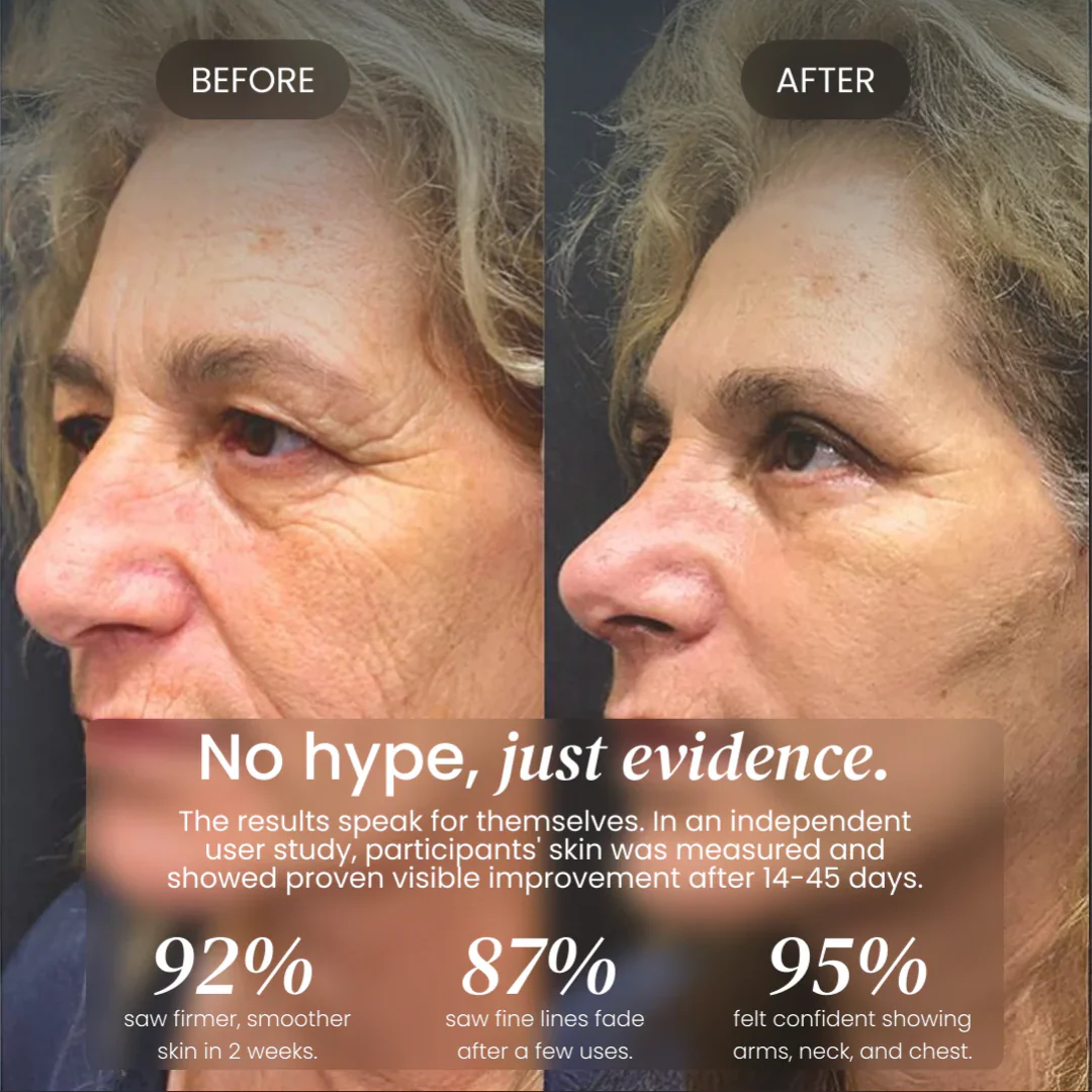 Advanced Crepe Fix for crepey, densely creased or paper like skin - Image 9