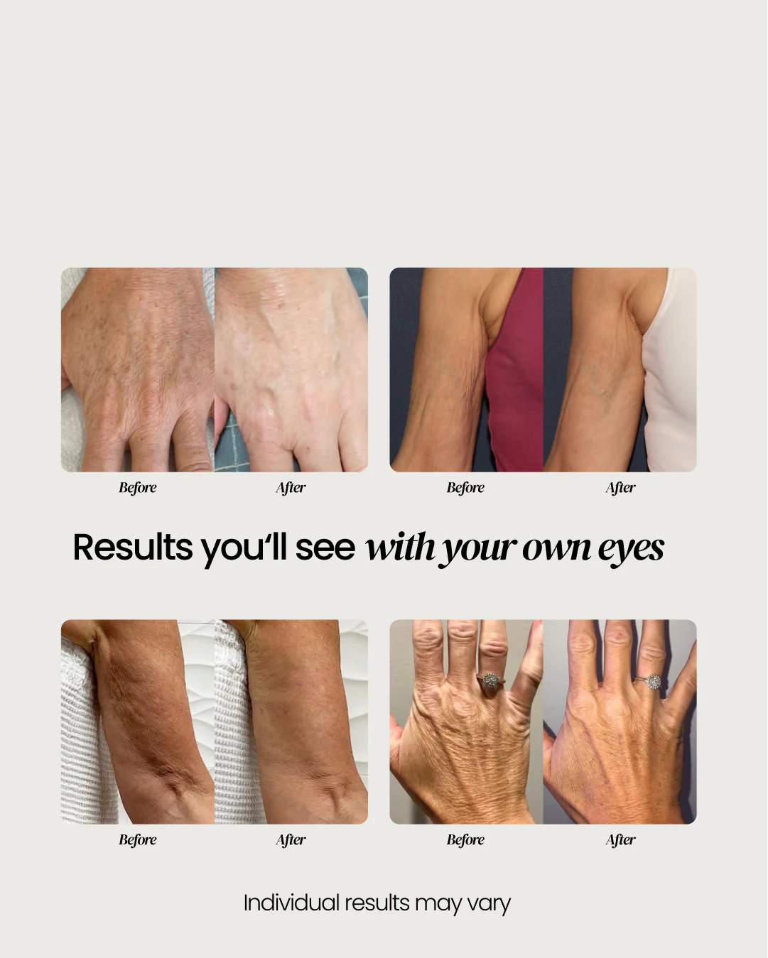 Advanced Crepe Skin Cream - Image 15