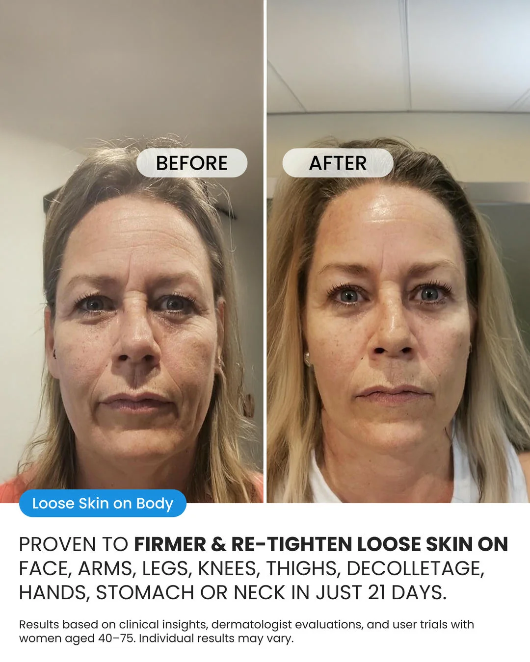 Advanced Crepe Skin Cream - Image 3