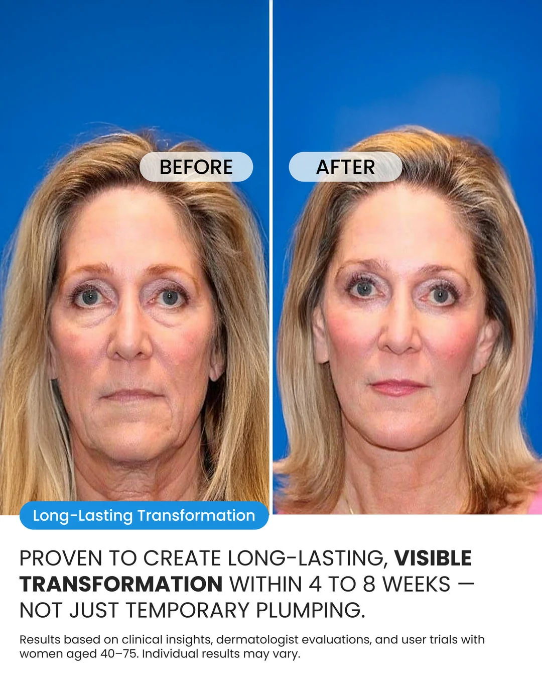 Advanced Crepe Skin Cream - Image 4