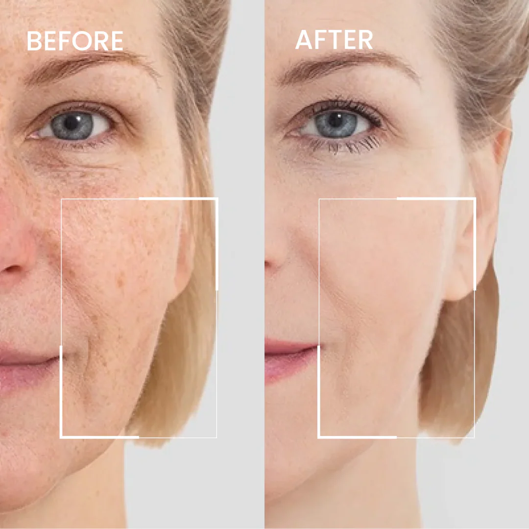 Aging Repair Cream for wrinkles, thinning and sagging skin - Image 2