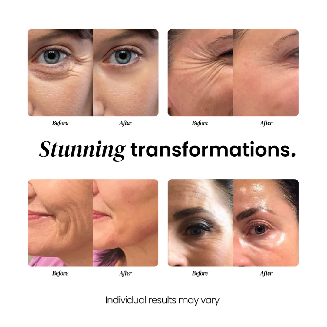 Aging Repair Cream for wrinkles, thinning and sagging skin - Image 3