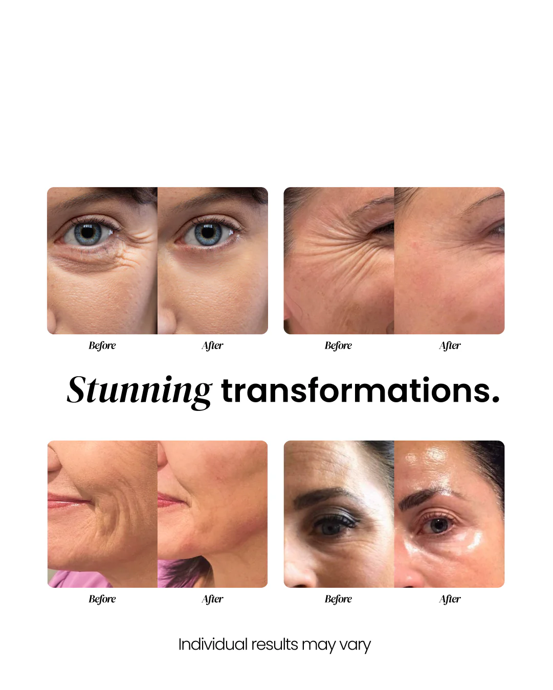 Anti-Aging Face Cream - Image 7