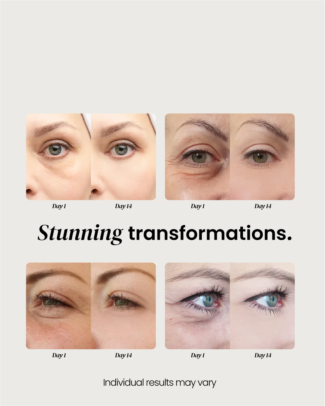 Anti-Aging Eye Cream for Wrinkles - Image 7
