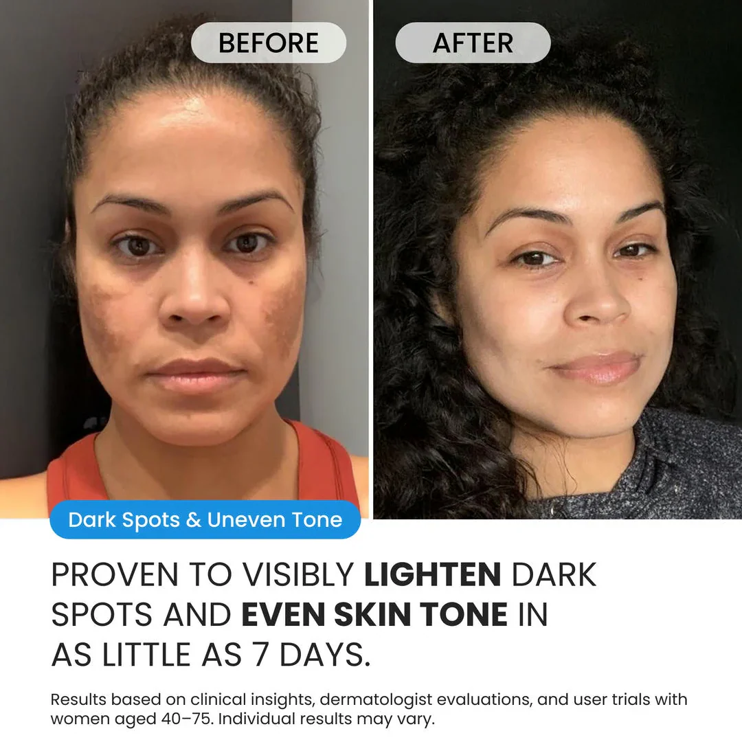 Dark Spot Corrector for Dark Spots, Melasma & Uneven Skin Tone - Image 2