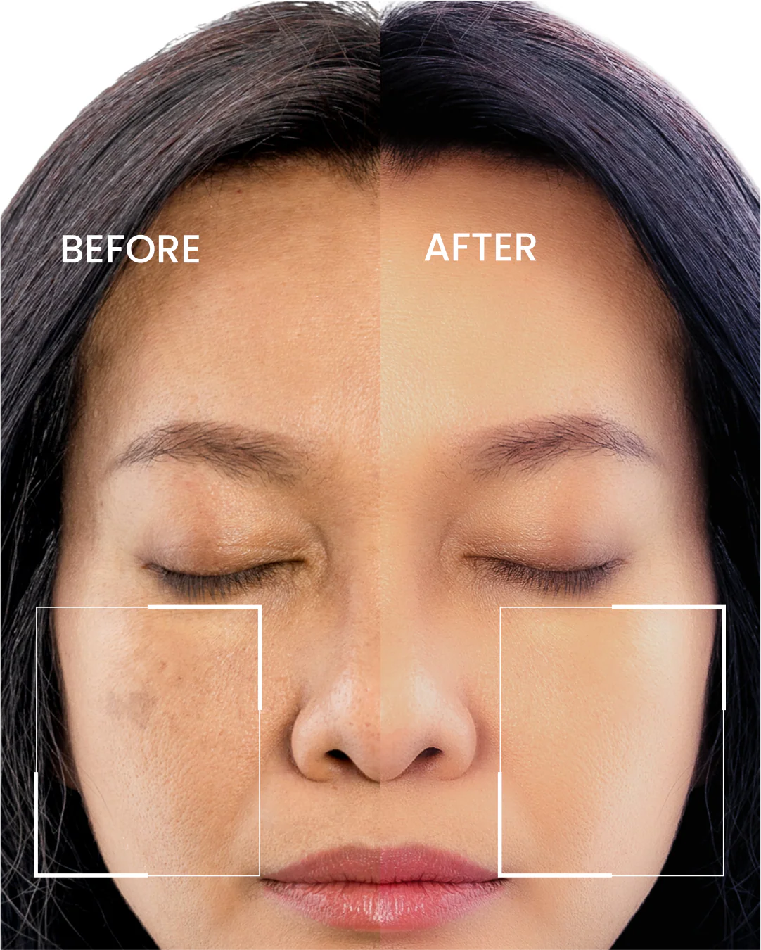 Dark Spot Corrector. - Image 2