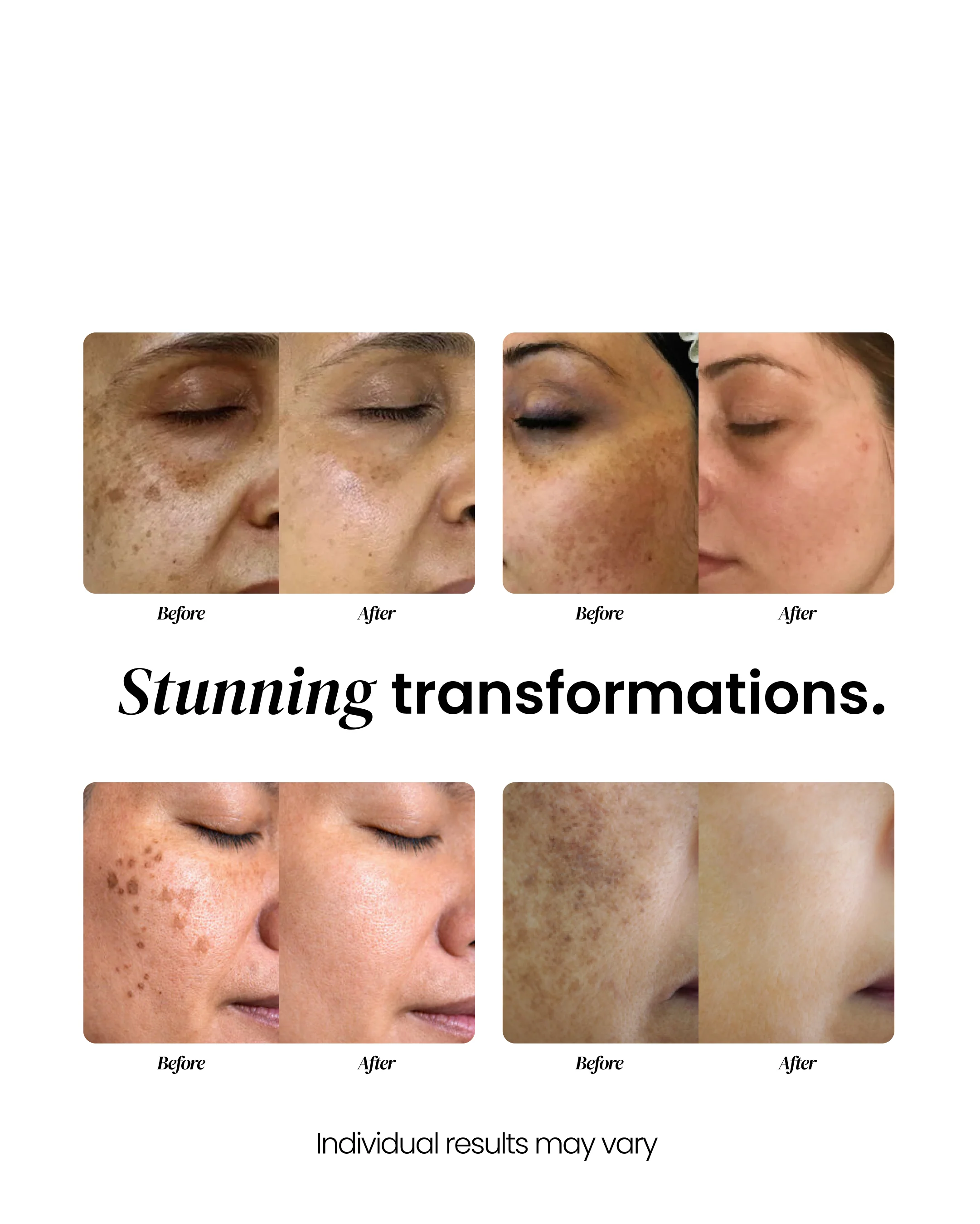 Dark Spot Corrector. - Image 7