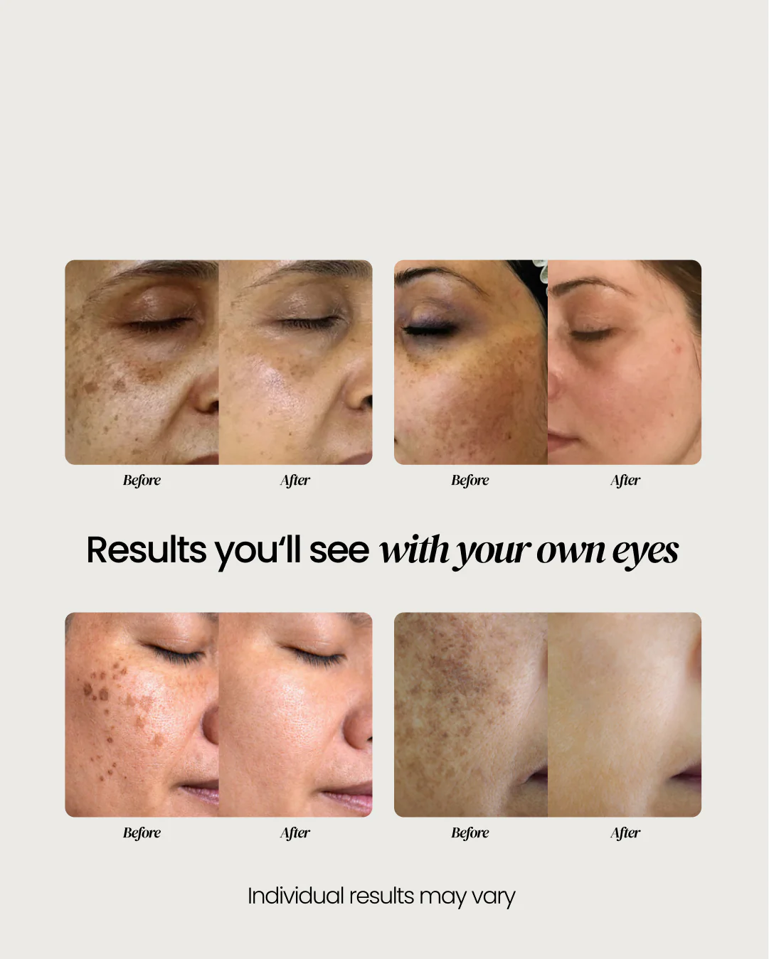 Dark Spot Corrector - Image 15