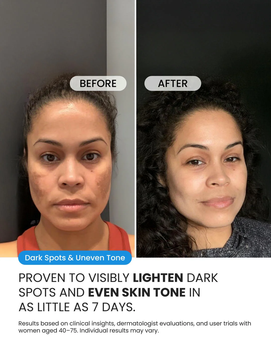Dark Spot Corrector - Image 2