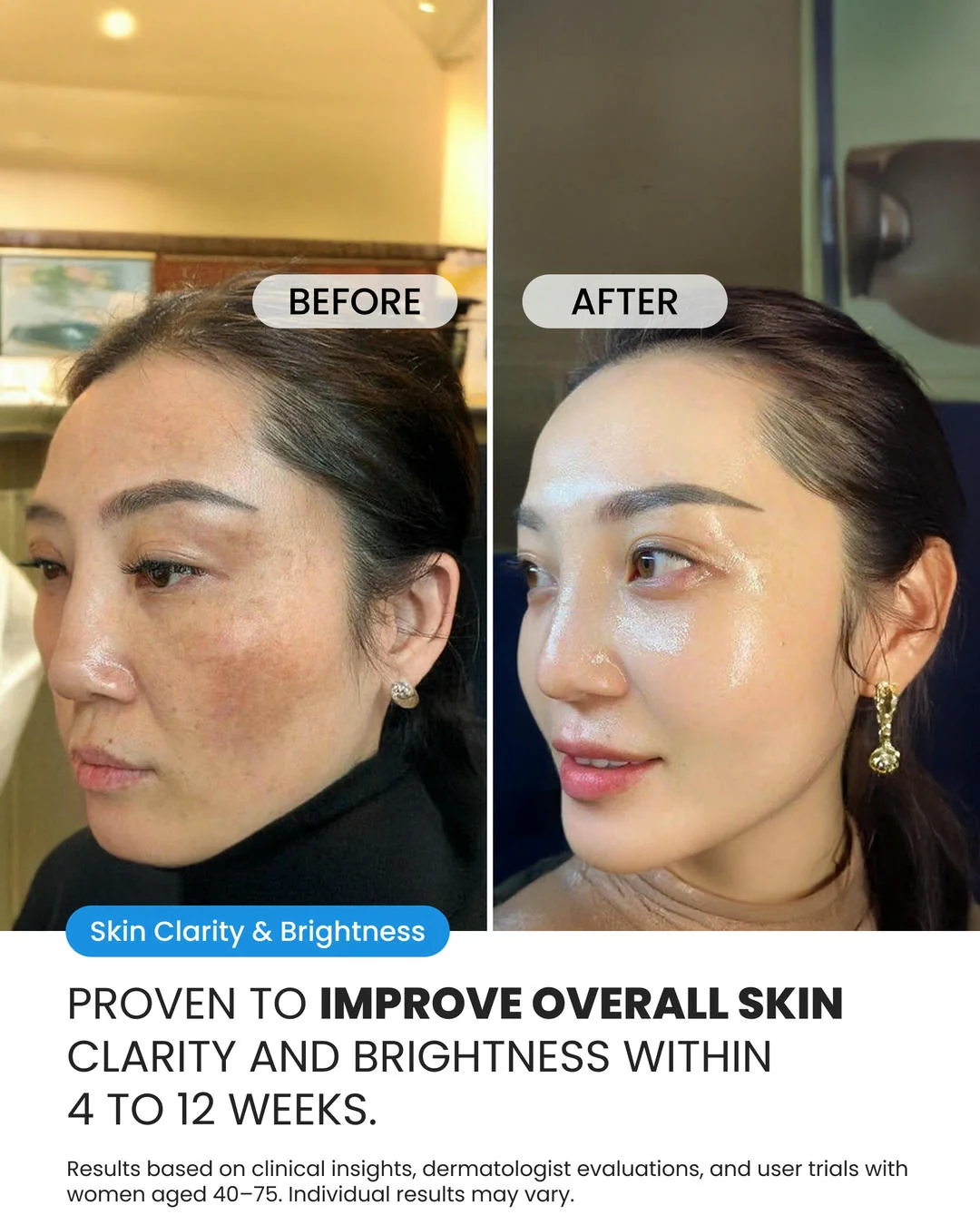 Dark Spot Corrector - Image 3