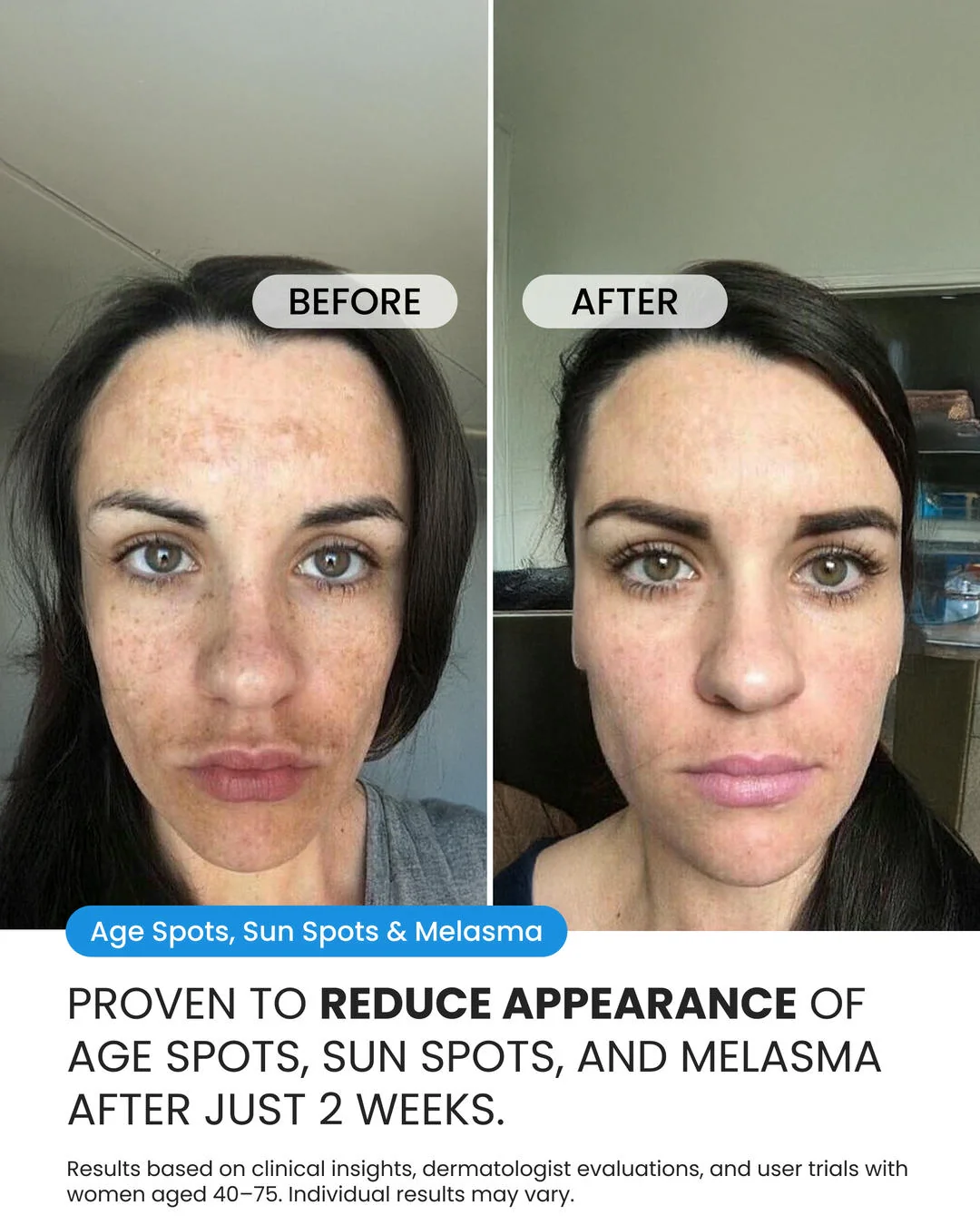 Dark Spot Corrector - Image 4