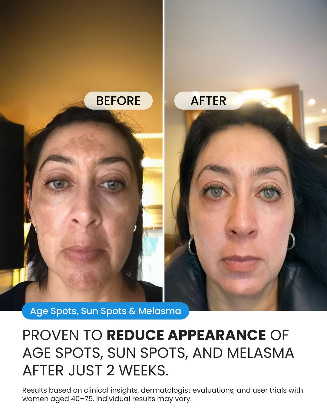 Dark Spot Corrector - Image 5