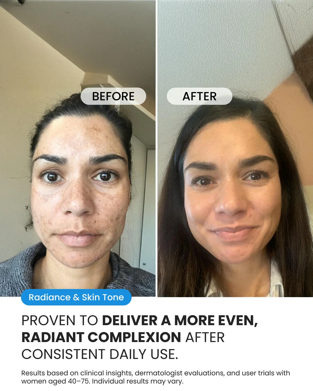 Dark Spot Corrector - Image 6