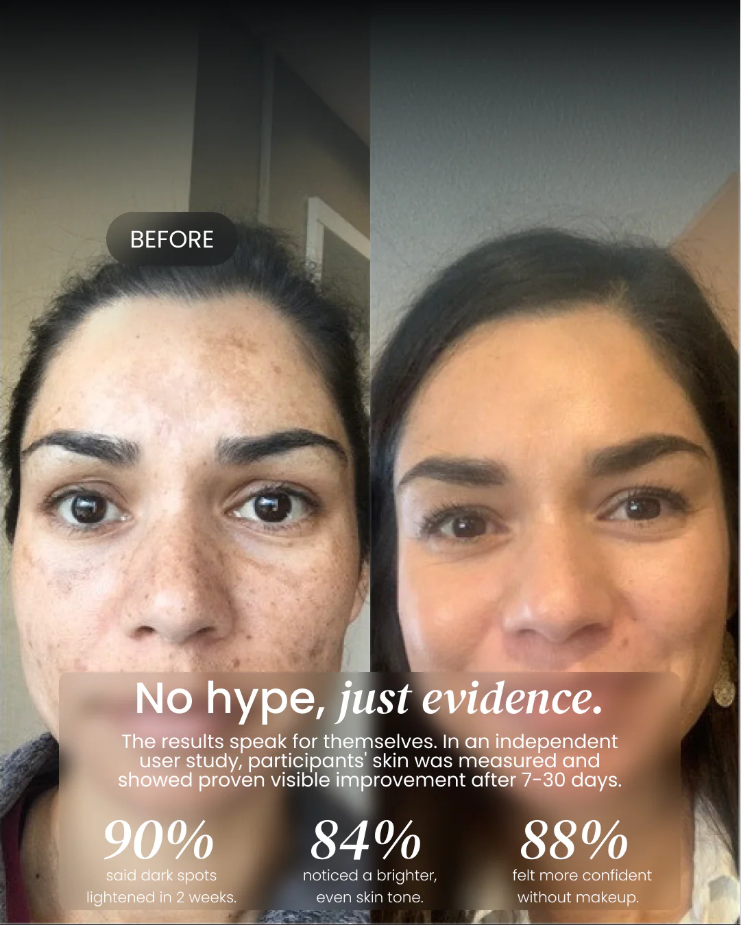 Dark Spot Corrector - Image 9