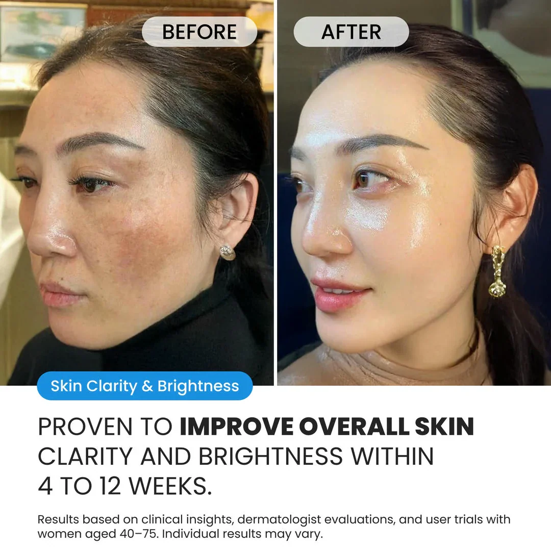 Dark Spot Corrector - Image 3