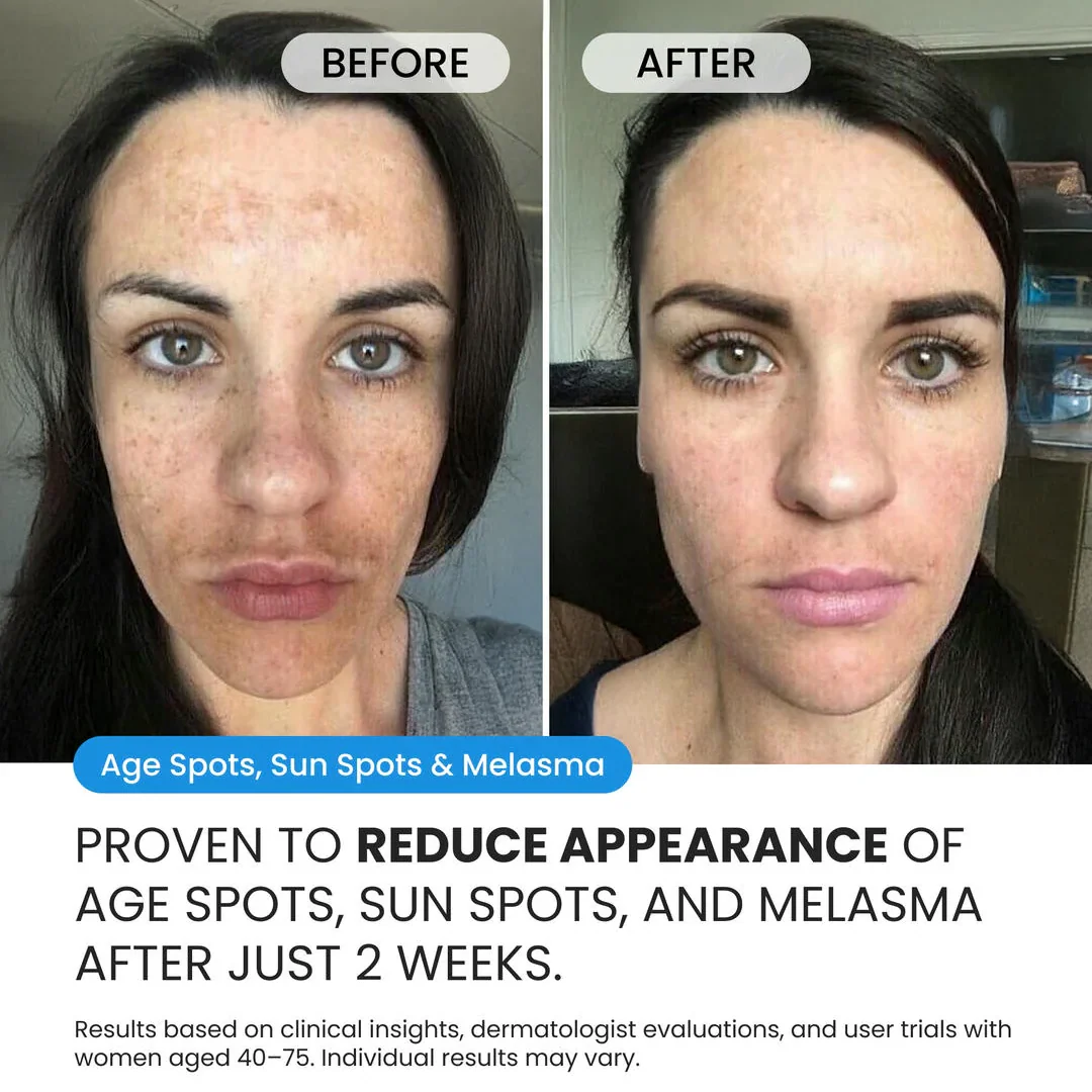 Dark Spot Corrector - Image 4