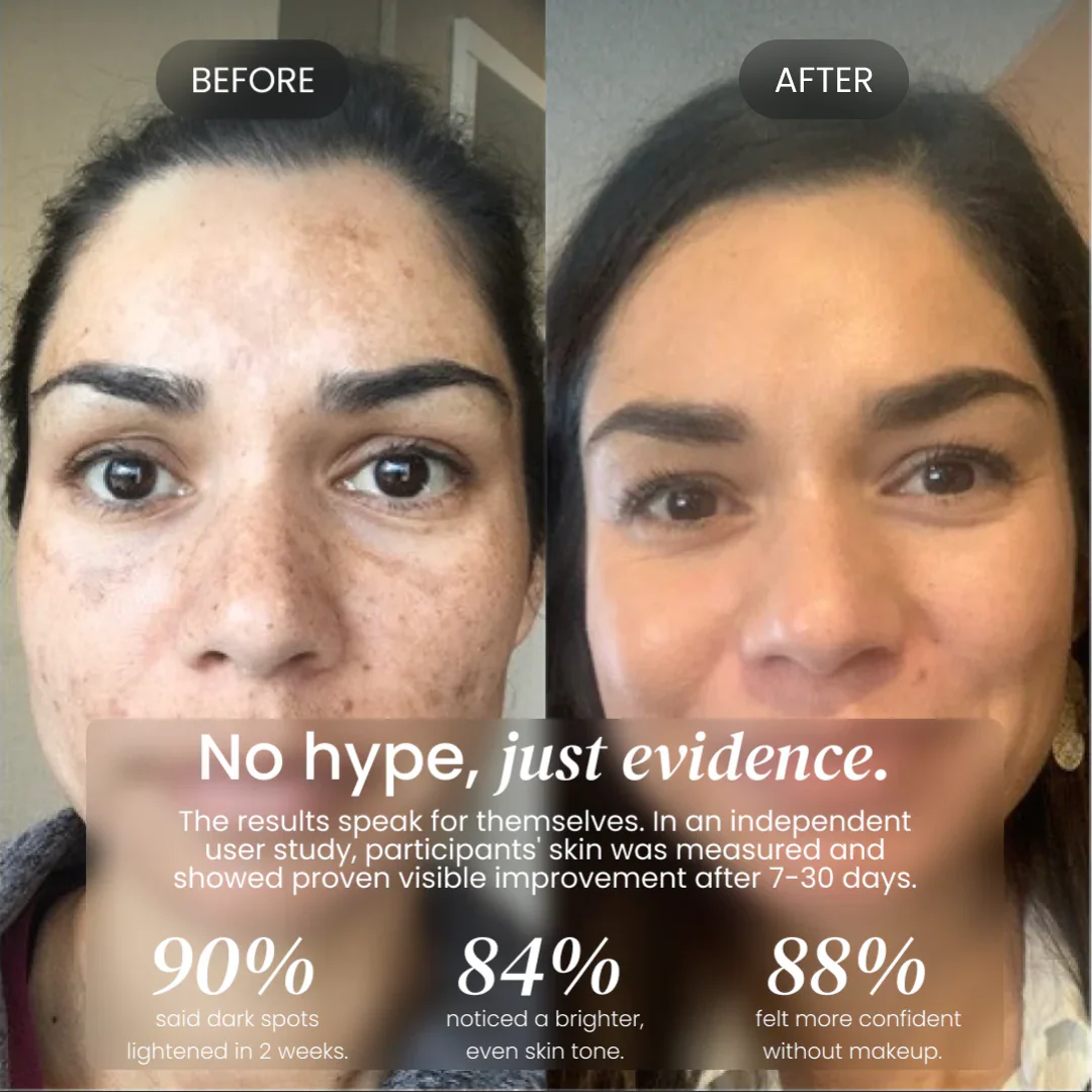 Dark Spot Corrector - Image 9