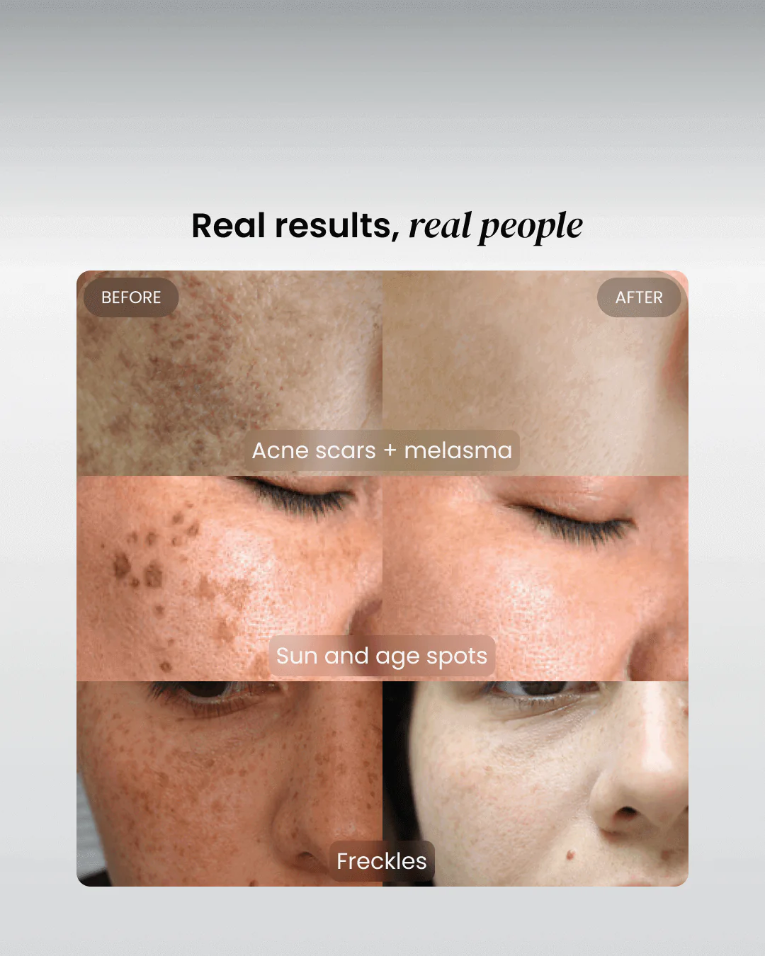 Dark Spot Corrector - Image 10