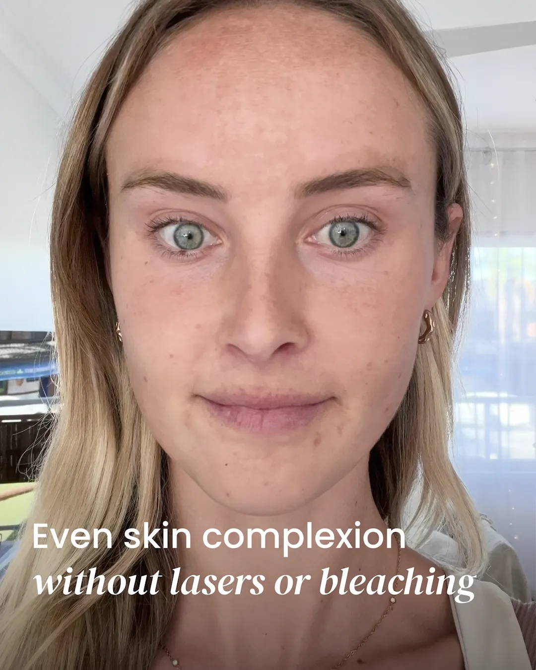 Dark Spot Corrector - Image 3