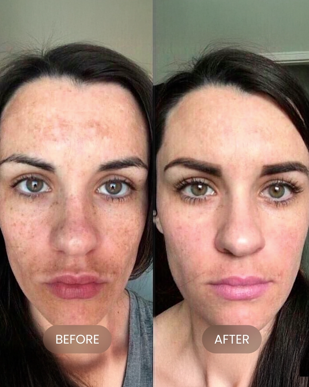 Dark Spot Corrector - Image 8