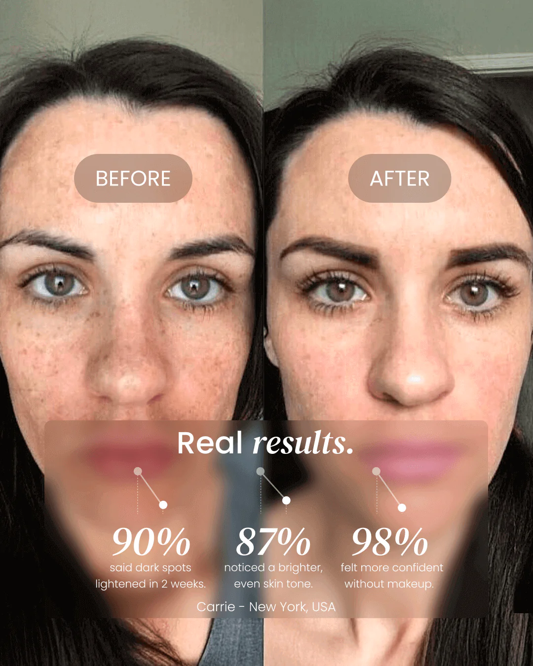 Dark Spot Corrector - Image 9