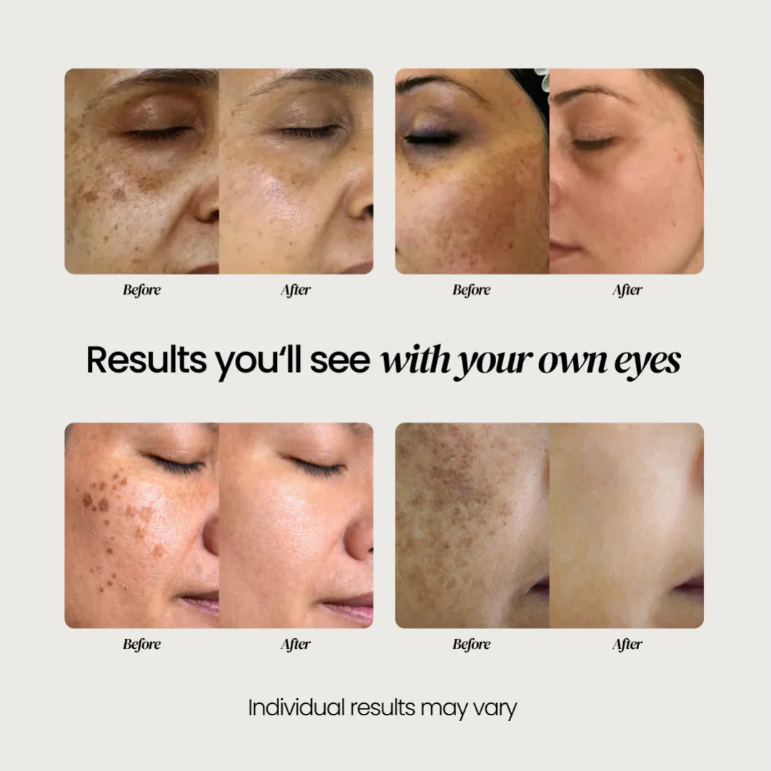 Dark Spot Corrector - Image 14