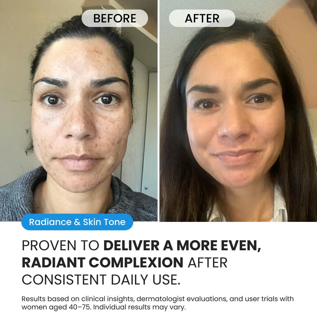 Dark Spot Corrector - Image 6