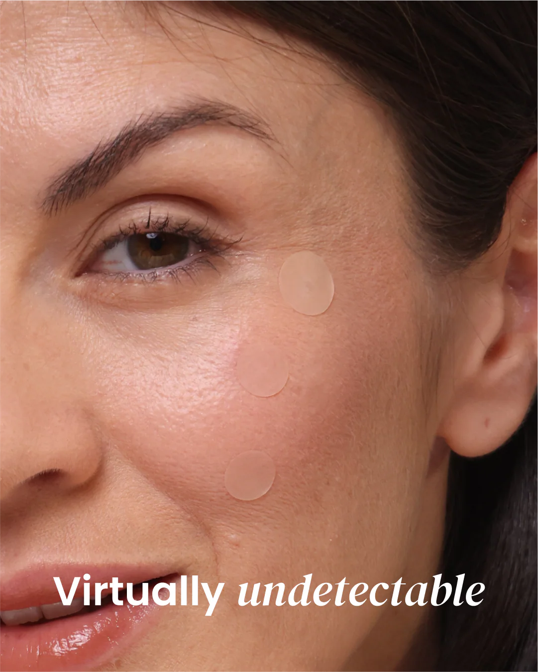 Hydrocolloid Pimple Patches - Image 4
