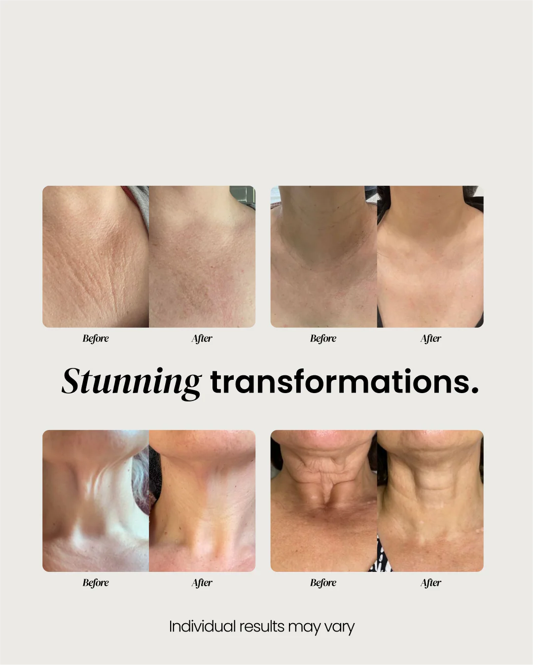 Elire Neck Cream - Image 7