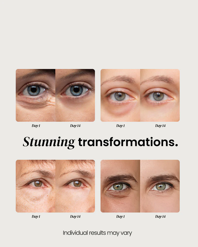 Repair Eye Cream for Dark Circles - Image 7