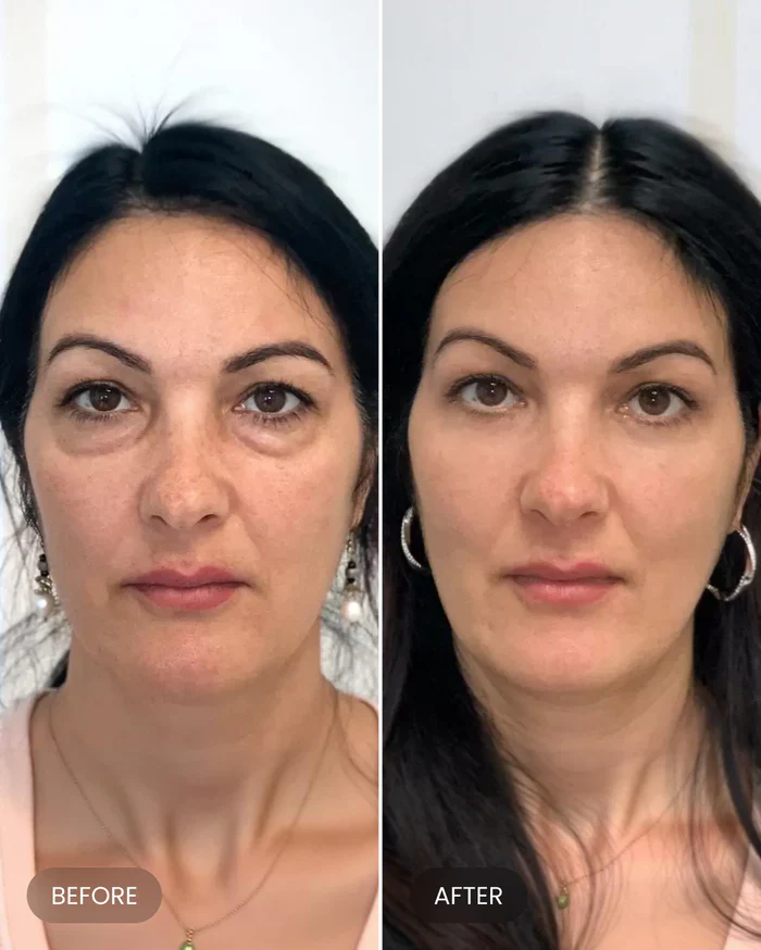 Firming Eye Cream - Image 11