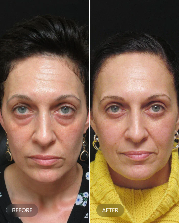 Firming Eye Cream - Image 12