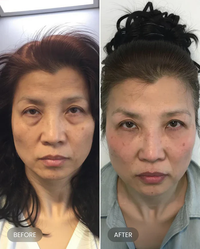 Firming Eye Cream - Image 14