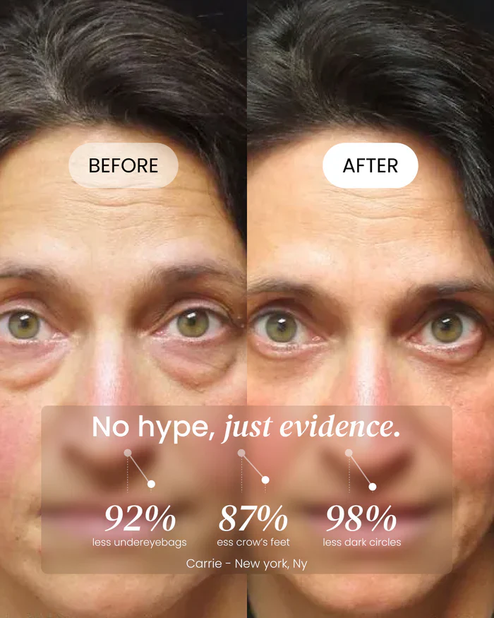 Firming Eye Cream - Image 9