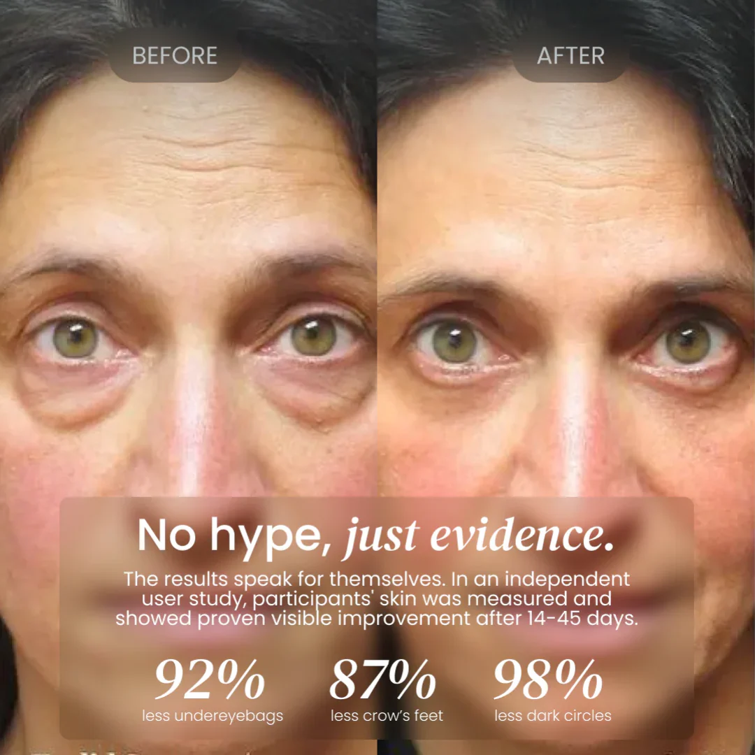 Firming Eye Cream for fines lines, deep wrinkles and under-eye puffiness - Image 10