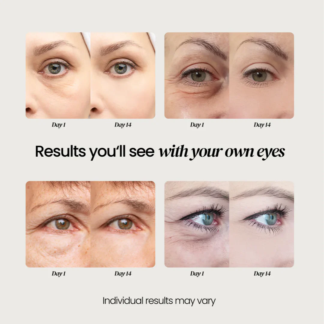 Firming Eye Cream for fines lines, deep wrinkles and under-eye puffiness - Image 15