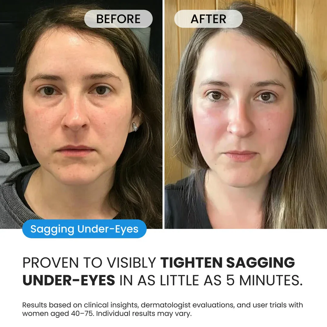 Firming Eye Cream for fines lines, deep wrinkles and under-eye puffiness - Image 2