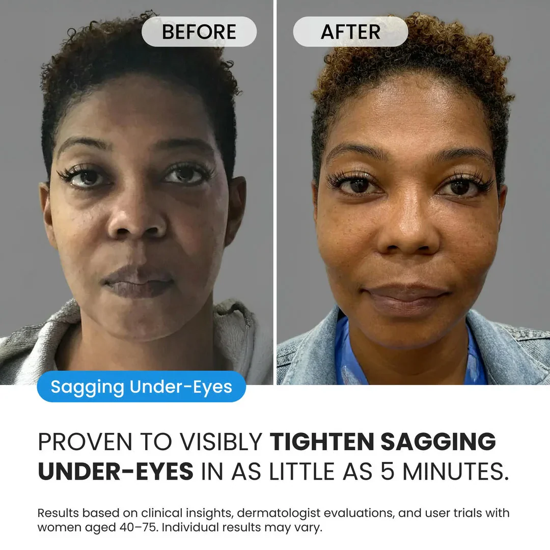 Firming Eye Cream for fines lines, deep wrinkles and under-eye puffiness - Image 4