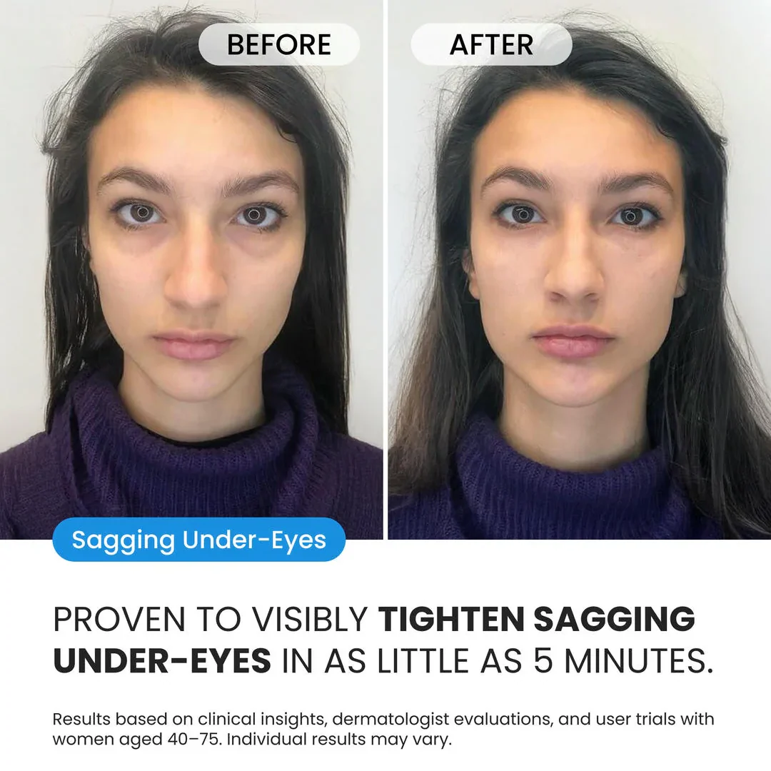 Firming Eye Cream for fines lines, deep wrinkles and under-eye puffiness - Image 7