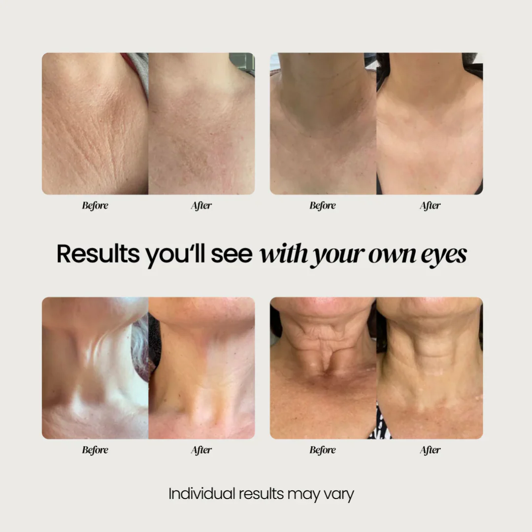 Neck Cream for sagging skin, deep creases and neck lines - Image 14