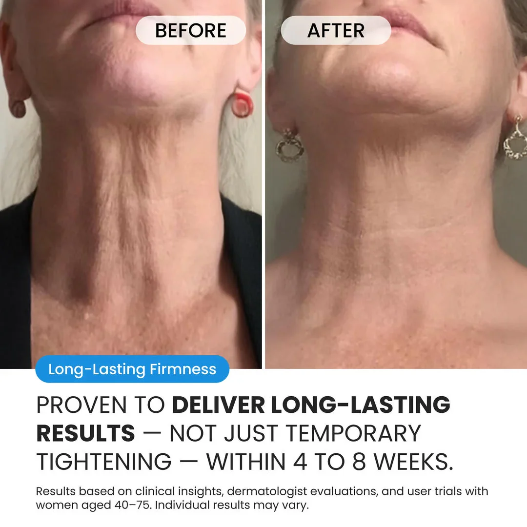 Neck Cream for sagging skin, deep creases and neck lines - Image 3