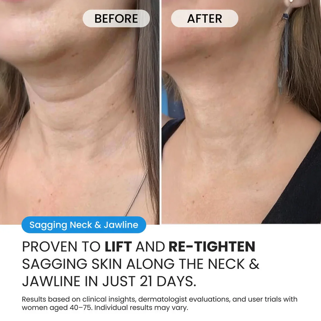 Neck Cream for sagging skin, deep creases and neck lines - Image 4