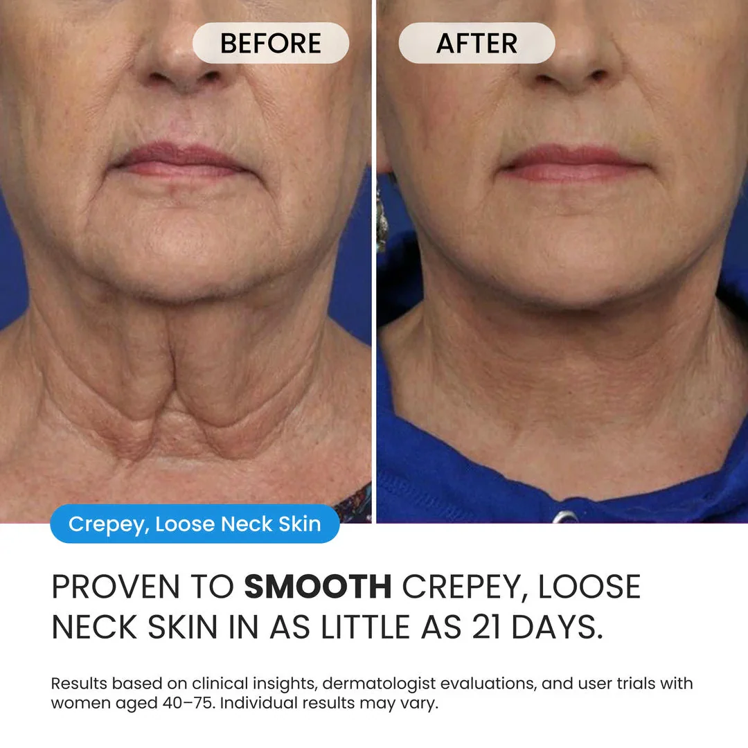 Neck Cream for sagging skin, deep creases and neck lines - Image 5
