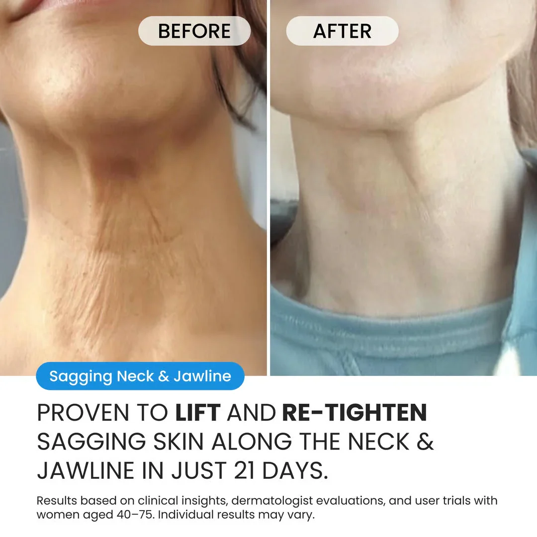 Neck Cream for sagging skin, deep creases and neck lines - Image 6