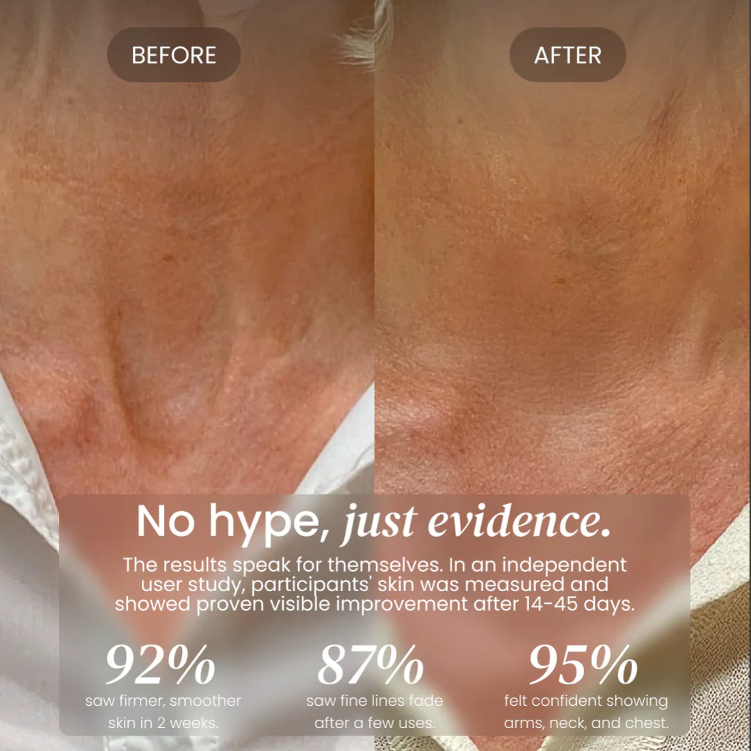 Neck Cream for sagging skin, deep creases and neck lines - Image 9