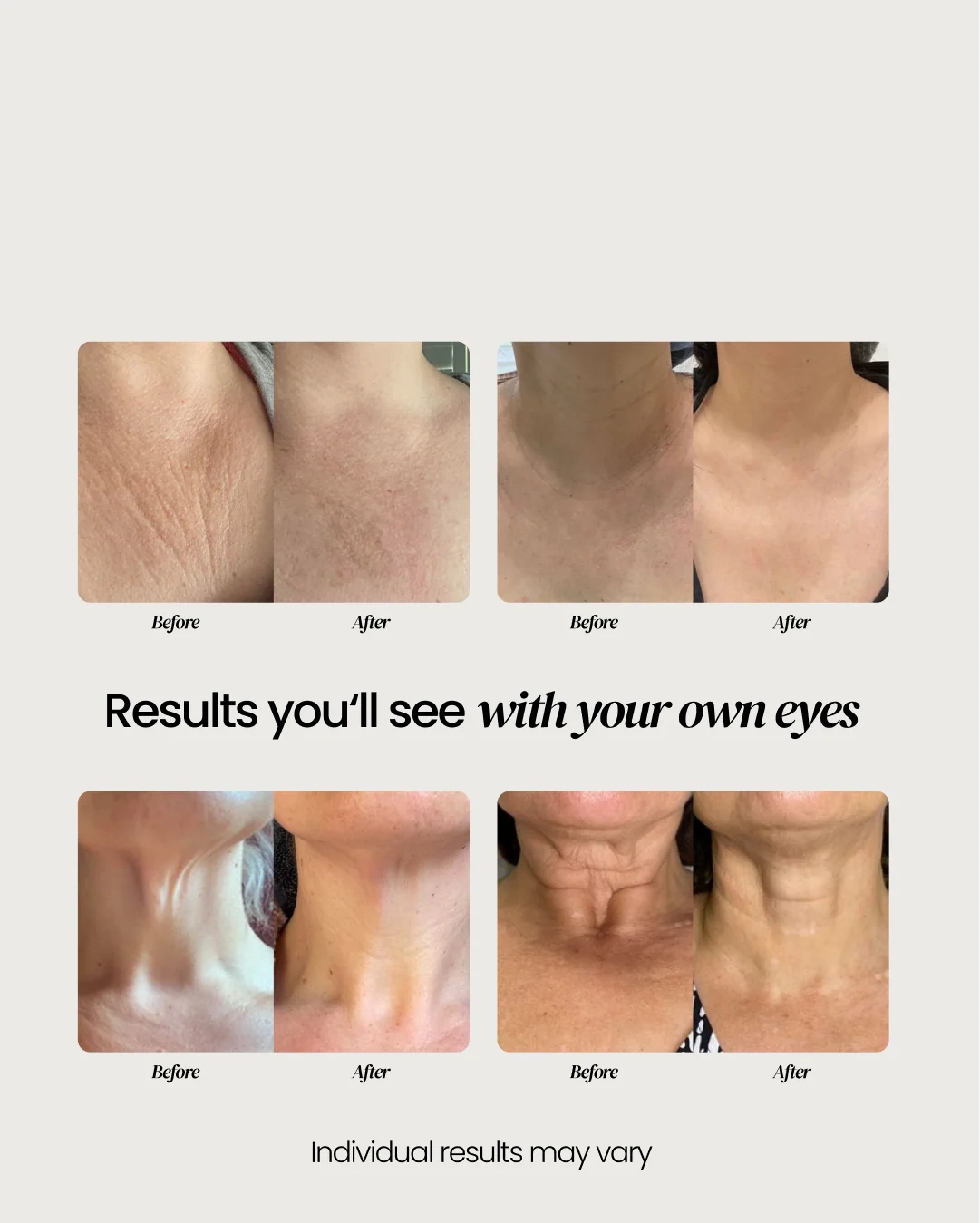 Neck Firming Cream - Image 15