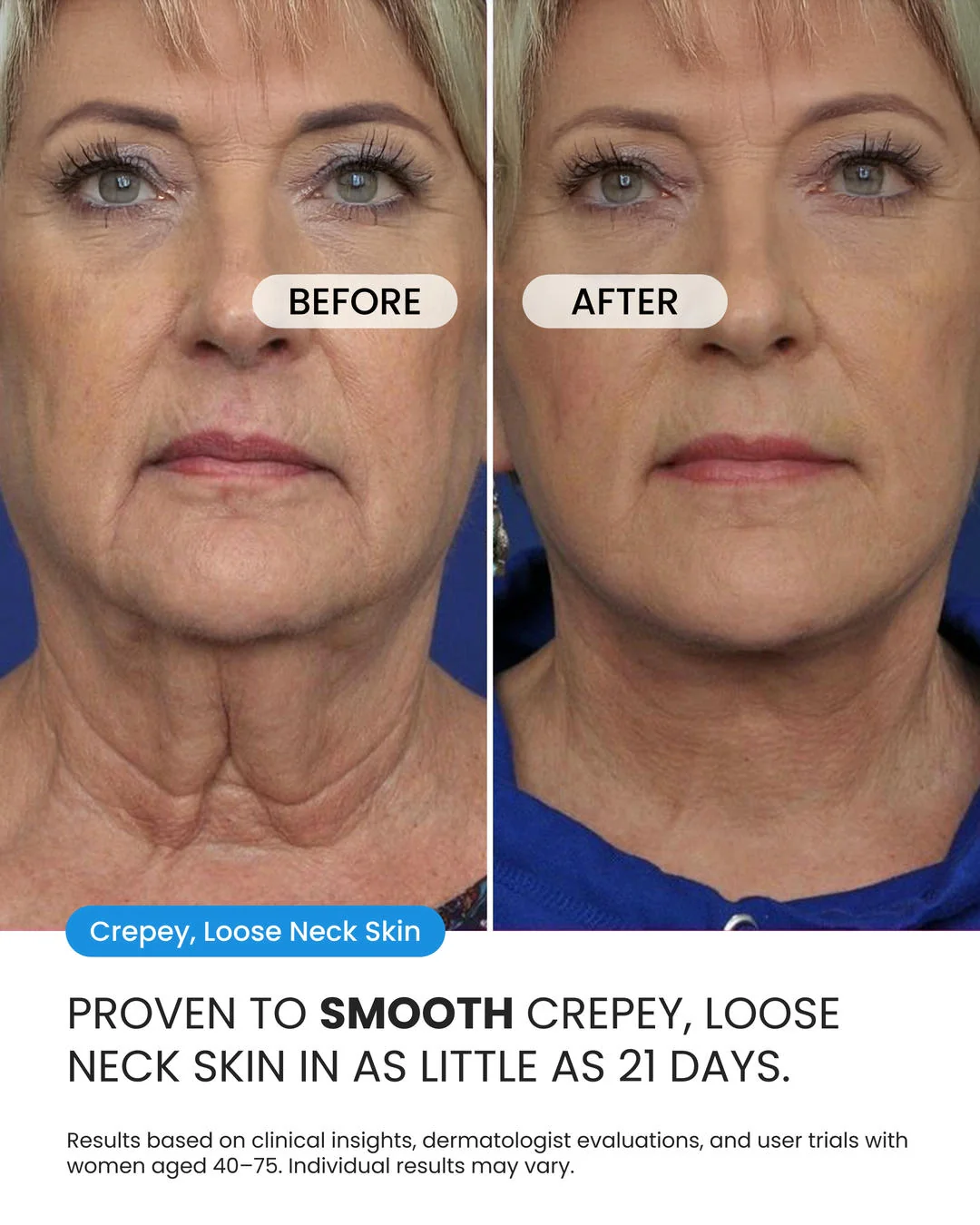 Neck Firming Cream - Image 5